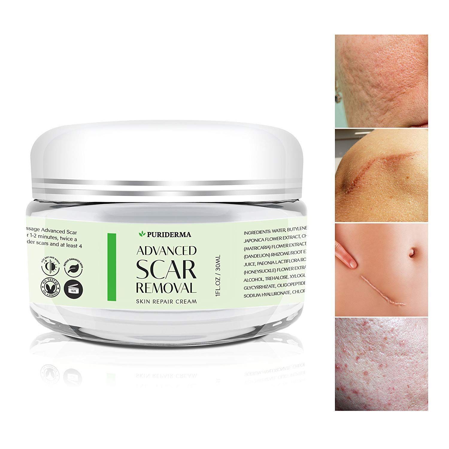 How should you take care of your scars after skin surgery? post thumbnail image