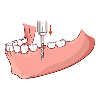 Get to know a safe place through your Mount waverley dentist post thumbnail image