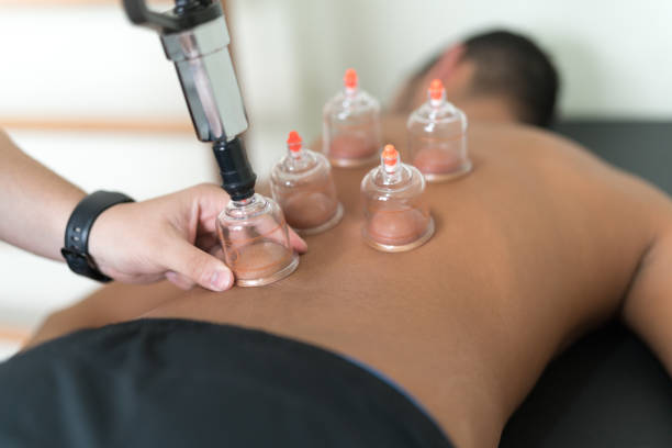 One Cupping Therapy Singapore with real therapeutic benefits post thumbnail image