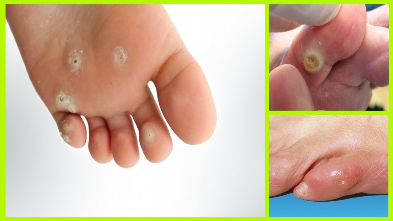 Do you know the benefits of going to a podiatrist? post thumbnail image