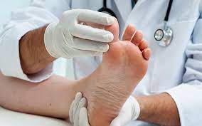 Get the Best foot care Services in Nassau County post thumbnail image